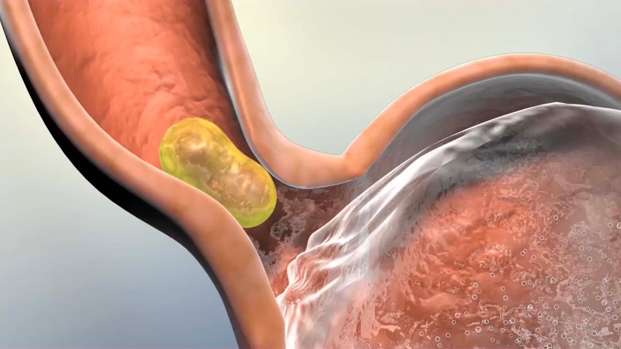absorber un organismo unicelular su alimento