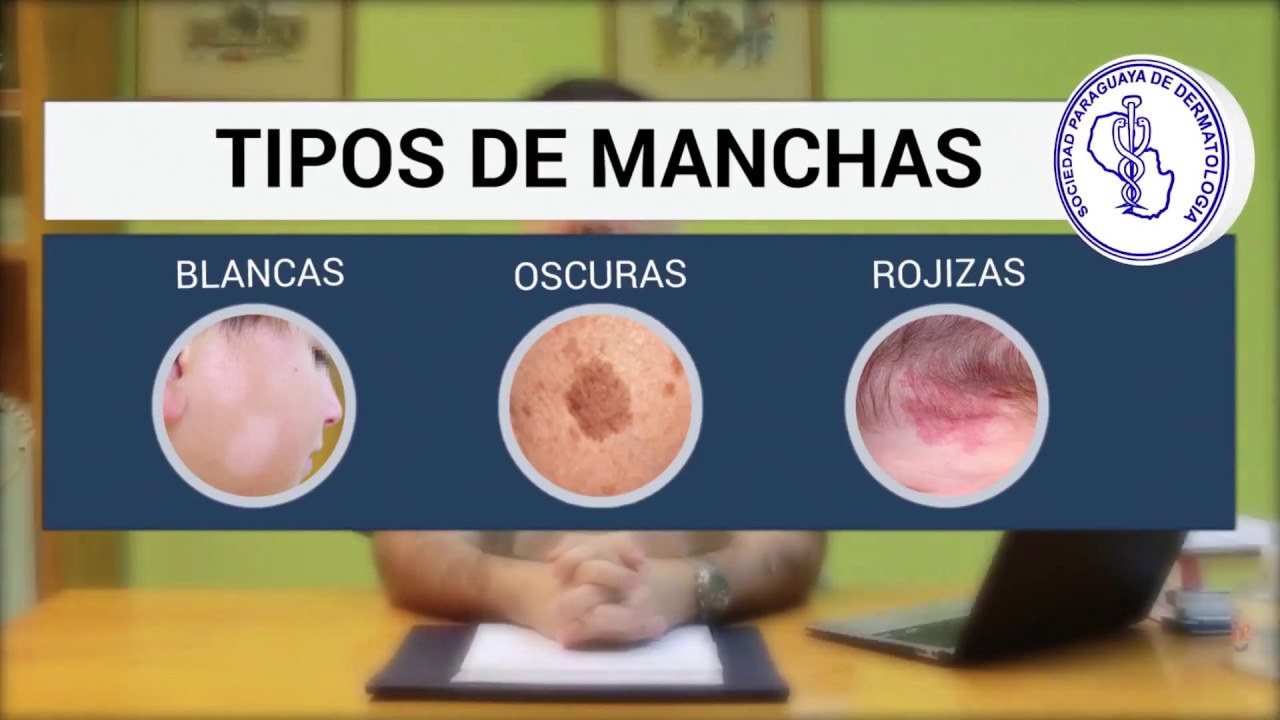 que posee manchas redondas y bicolor en las alas