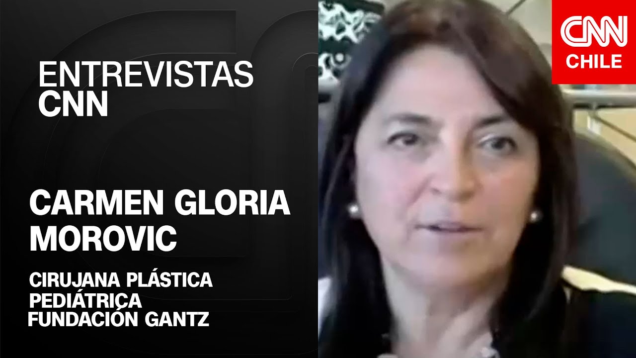 diagnostico de enfermeria para labio leporino y paladar hendido