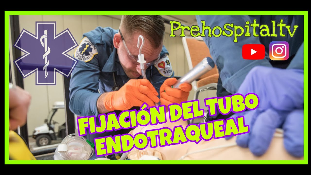 fijacion de tubo endotraqueal en pediatria