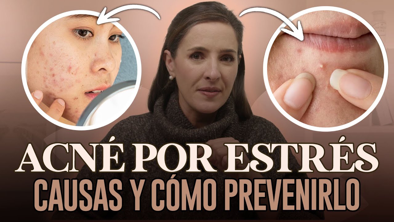 como se ve el estres en la piel