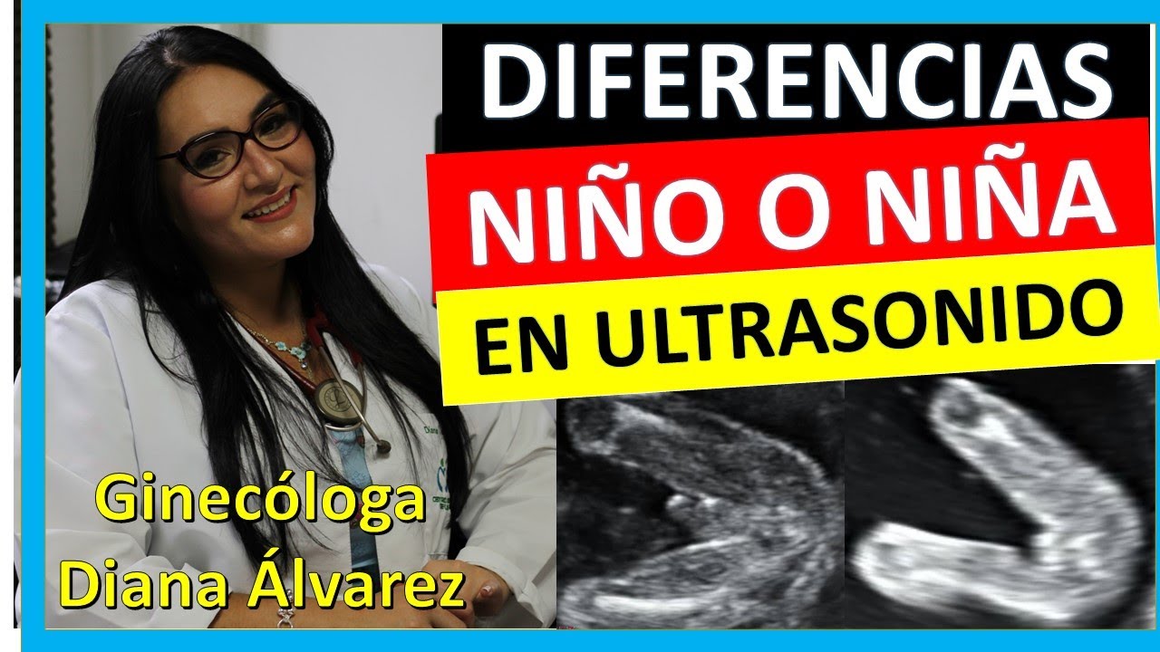 como se ve en el ultrasonido si es niño