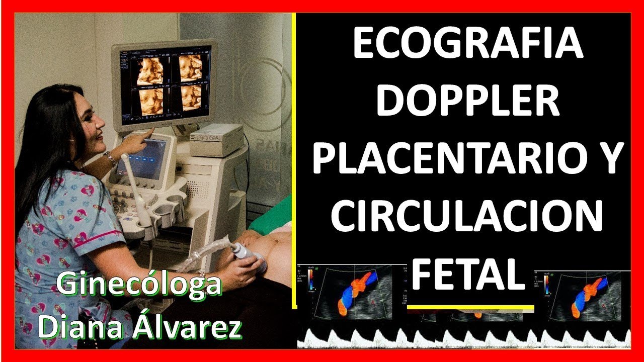 ecografia doppler a las cuantas semanas se hace