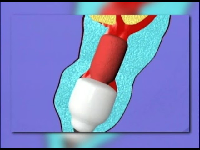 es malo meterse al mar con la menstruacion