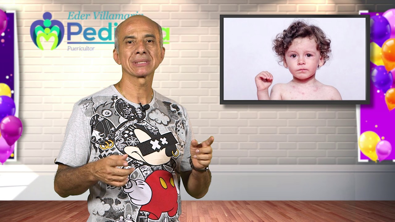 porque un niño suda mucho la cabeza