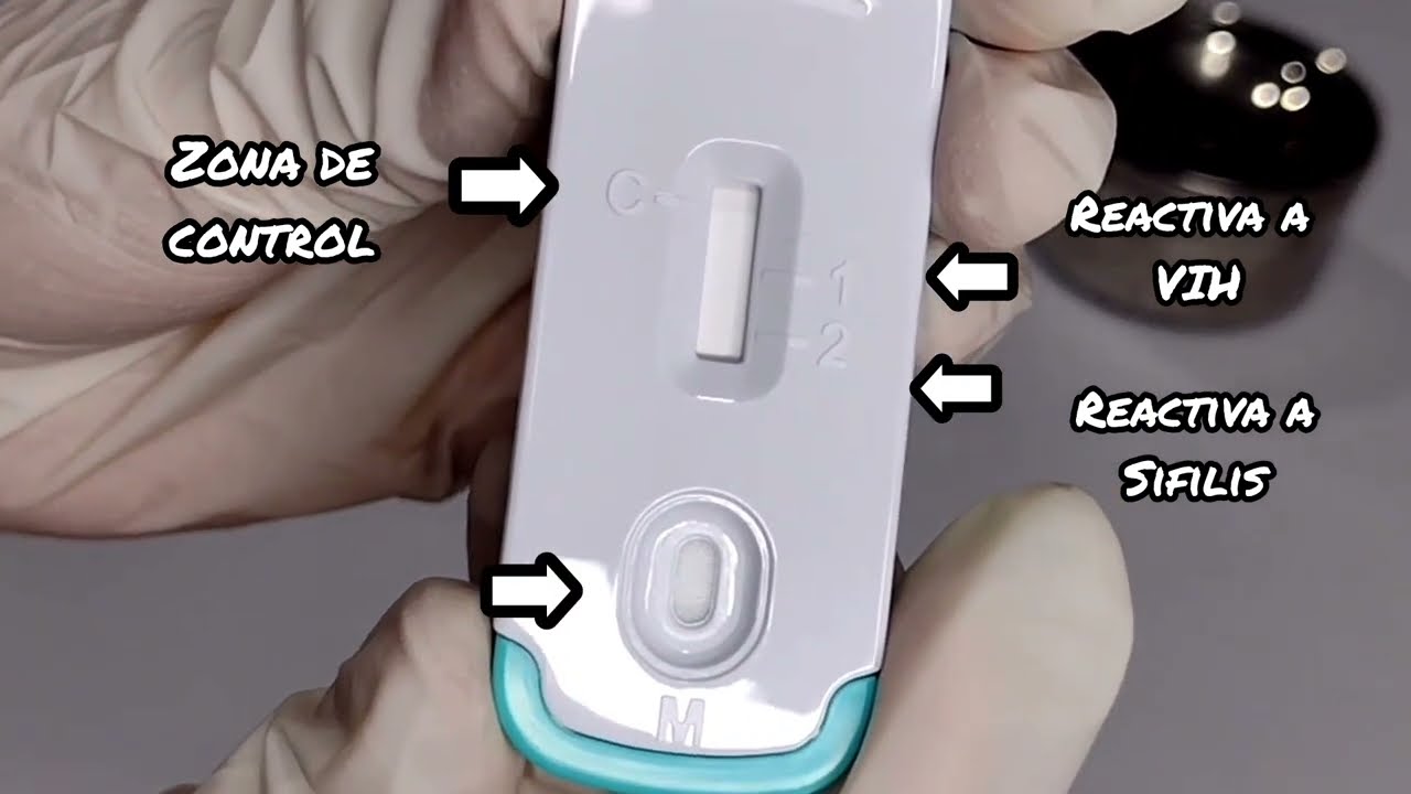 prueba rapida de vih y sifilis