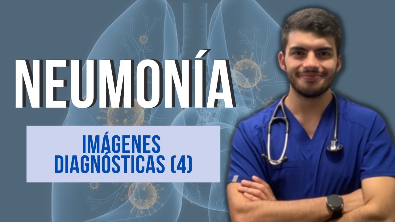 radiografia de torax neumonia en niños