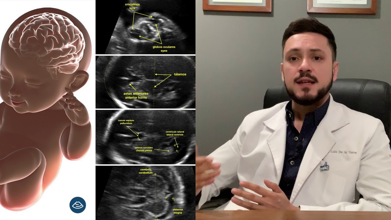 como se ve un ultrasonido estructural